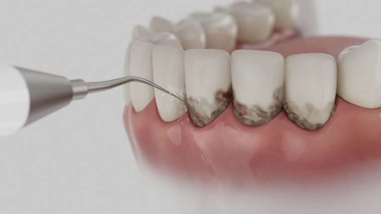 Reliable Dental Implants contractor in Rapid Valley, SD by Smile Center Dentistry